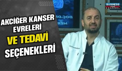 AKCİĞER KANSERİNDE TEDAVİ SEÇENEKLERİ VE EVRELERİ: CERRAHİ MÜDAHALE ÖNEMLİ