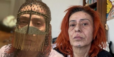 yildiz-tilbenin-yanik-yuzuyle-maskeli-pozu-dikkat-cekti-mBmSdxzn-1024x515