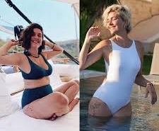 25 kilo veren Bergüzar Korel’den samimi itiraf!